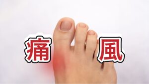 痛風のイメージ図