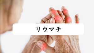 リウマチのイメージ図